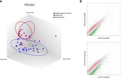 Analysis of Gastric Cancer Transcriptome Allows the Identification of Histotype Specific Molecular Signatures With Prognostic Potential